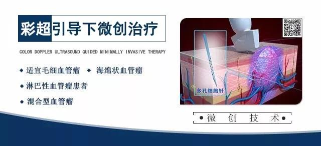 彩超引导治疗血管瘤，微创治疗血管瘤，昆明治疗血管瘤技术