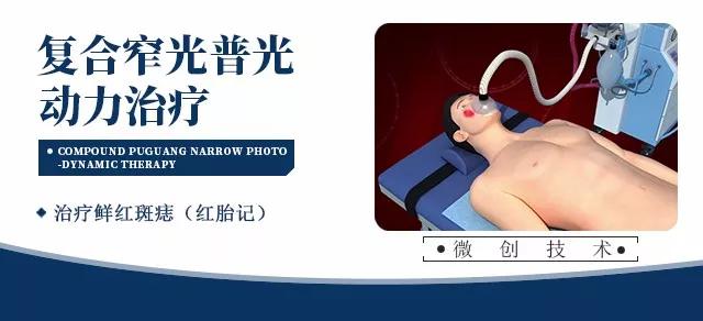  复合窄光普光动力治疗鲜红斑痣， 复合窄光普光动力治疗血管瘤